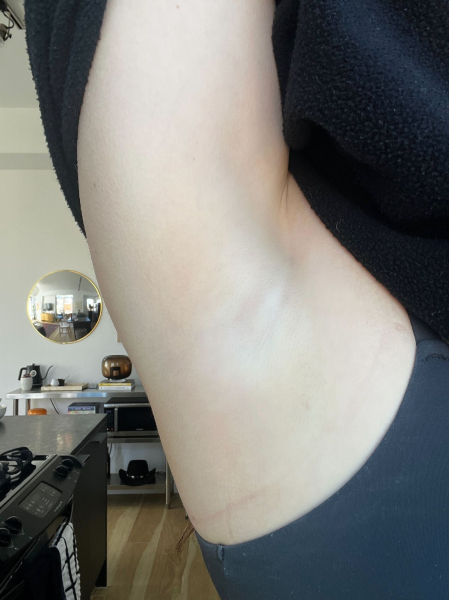 A shot of a woman's armpit after using Braun Skin iExpert